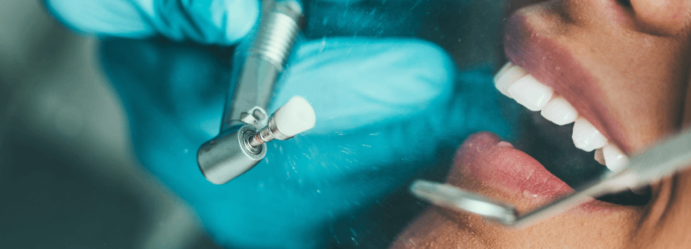 Oral Hygiene at Dental World of Marietta