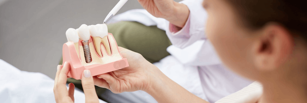 Dental Crowns in Marietta